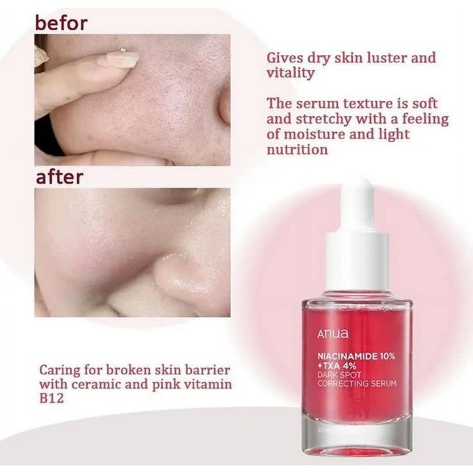 Anua Niacinamide 10% + TXA 4% Dark Spot Correcting Serum – 30ml - Botora Hub